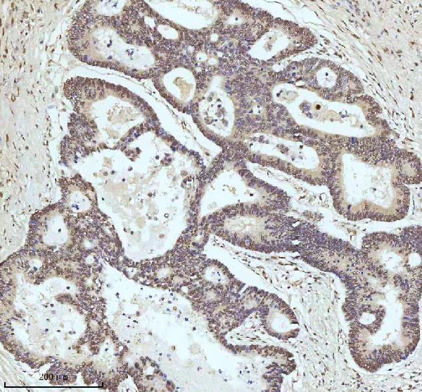 2 - Anti-53BP1 TP53BP1 Rabbit Monoclonal Antibody ABO13787
