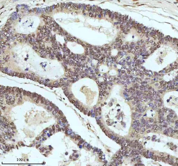 2 - Anti-53BP1 TP53BP1 Rabbit Monoclonal Antibody ABO13787