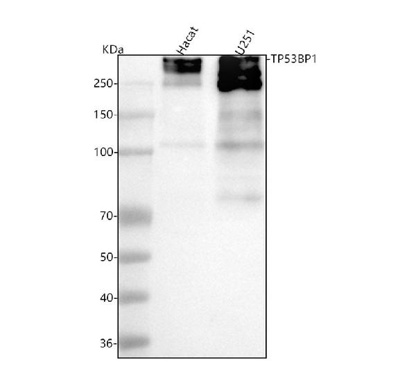 1 - Anti-53BP1 TP53BP1 Rabbit Monoclonal Antibody ABO13787