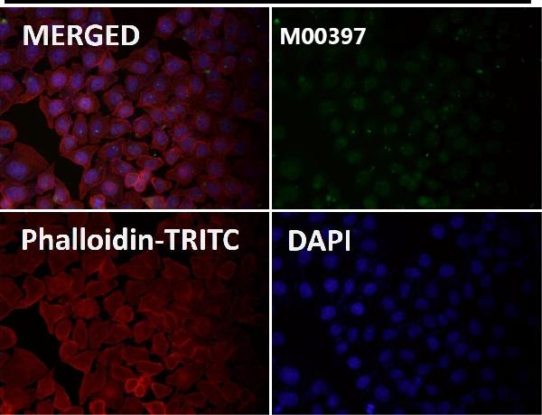 1 - Anti-53BP1 TP53BP1 Rabbit Monoclonal Antibody ABO13787