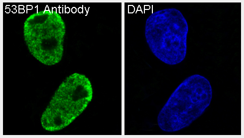 3 - Anti-53BP1 TP53BP1 Rabbit Monoclonal Antibody ABO13787