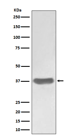 1 - Anti-SFRP1 Rabbit Monoclonal Antibody ABO13788