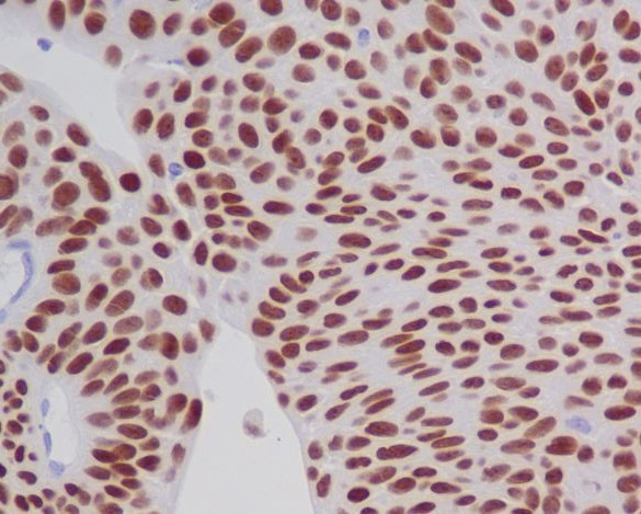 2 - Anti-GATA3 Rabbit Monoclonal Antibody ABO13789