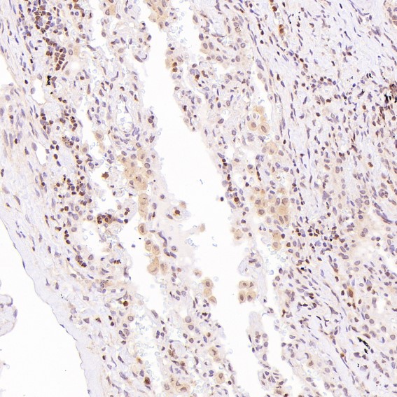 2 - Anti-GATA3 Rabbit Monoclonal Antibody ABO13789
