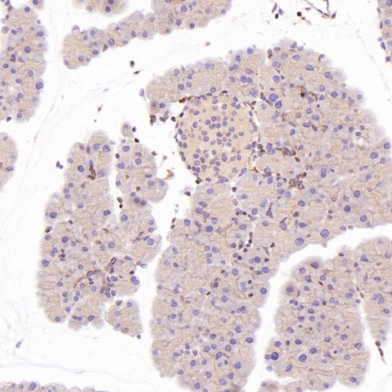 2 - Anti-GATA3 Rabbit Monoclonal Antibody ABO13789