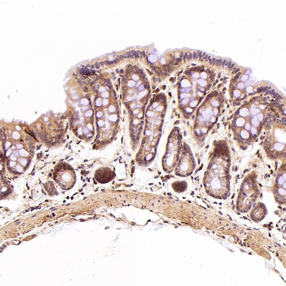 2 - Anti-GATA3 Rabbit Monoclonal Antibody ABO13789