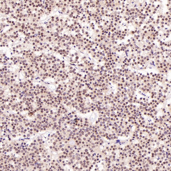 2 - Anti-GATA3 Rabbit Monoclonal Antibody ABO13789