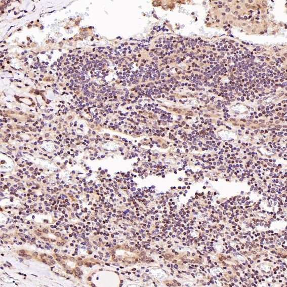 2 - Anti-GATA3 Rabbit Monoclonal Antibody ABO13789