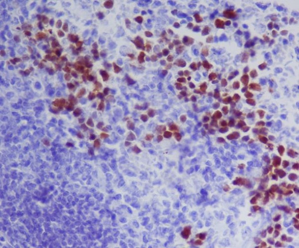 2 - Anti-GATA1 Rabbit Monoclonal Antibody ABO13791