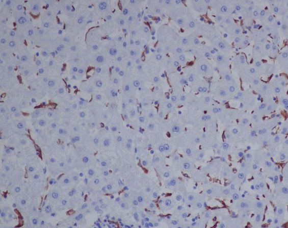 2 - Anti-CD163 Rabbit Monoclonal Antibody ABO13792