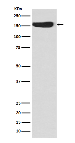 1 - Anti-CD163 Rabbit Monoclonal Antibody ABO13792