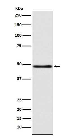 1 - Anti-GCET1 SERPINA9 Rabbit Monoclonal Antibody ABO13794