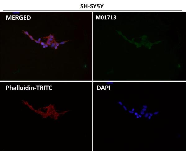 1 - Anti-EAAT2/GLT-1/SLC1A2 Rabbit Monoclonal Antibody ABO13795