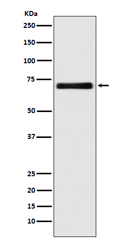 1 - Anti-EAAT2/GLT-1/SLC1A2 Rabbit Monoclonal Antibody ABO13795
