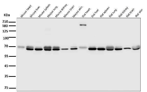 1 - Anti-EAAT2/GLT-1/SLC1A2 Rabbit Monoclonal Antibody ABO13795