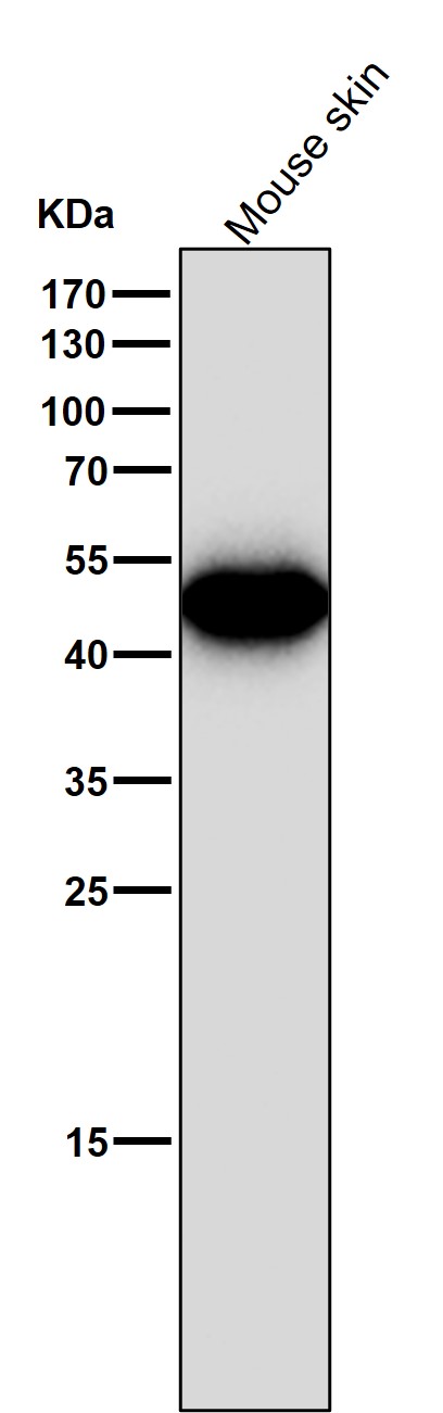 1 - Anti-Wnt5a Rabbit Monoclonal Antibody ABO13796