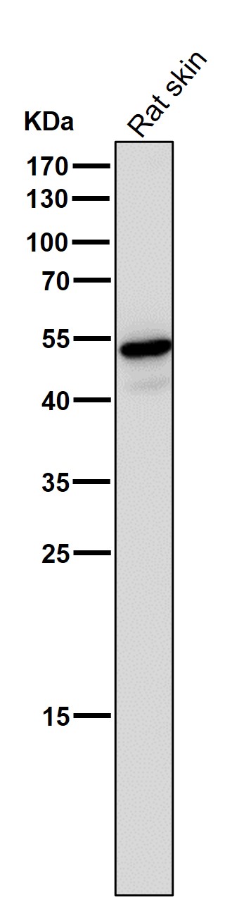 1 - Anti-Wnt5a Rabbit Monoclonal Antibody ABO13796