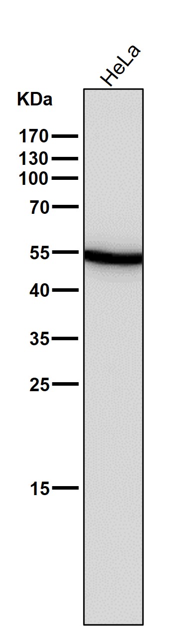 1 - Anti-Wnt5a Rabbit Monoclonal Antibody ABO13796