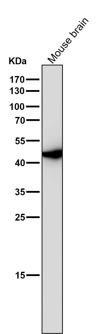 1 - Anti-Wnt5a Rabbit Monoclonal Antibody ABO13796