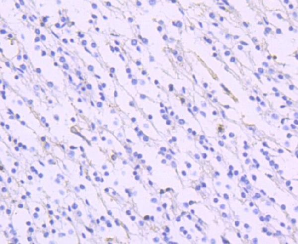 2 - Anti-EAAT1 SLC1A3 Rabbit Monoclonal Antibody ABO13797