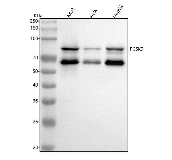 1 - Anti-PCSK9/Proprotein Convertase 9 Rabbit Monoclonal Antibody ABO13798