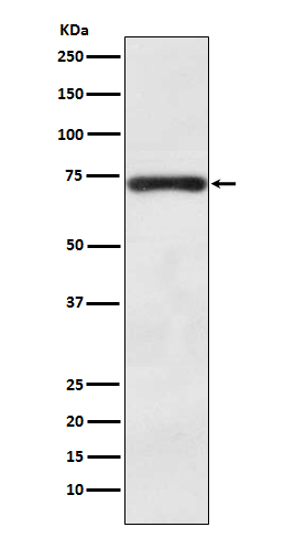 1 - Anti-BACE1/Bace Rabbit Monoclonal Antibody ABO13799