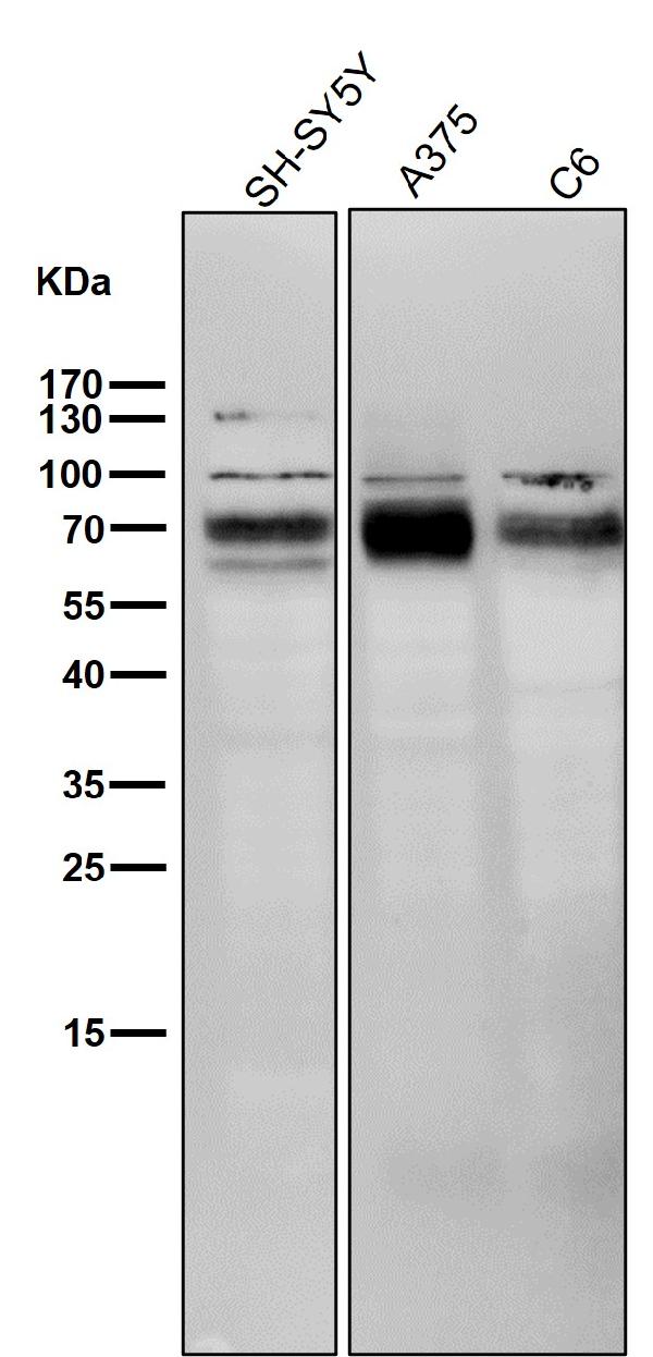 1 - Anti-BACE1/Bace Rabbit Monoclonal Antibody ABO13799