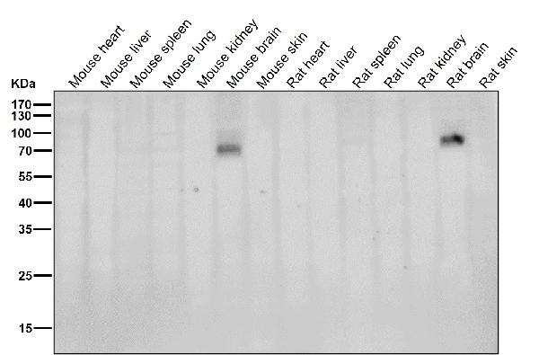 1 - Anti-BACE1/Bace Rabbit Monoclonal Antibody ABO13799