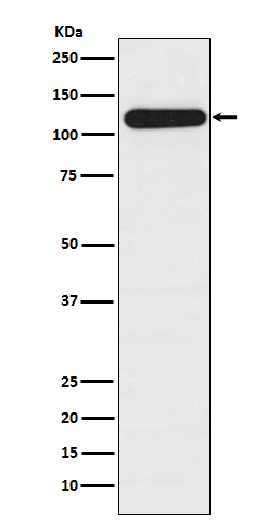 1 - Anti-BubR1 BUB1B Rabbit Monoclonal Antibody ABO13800
