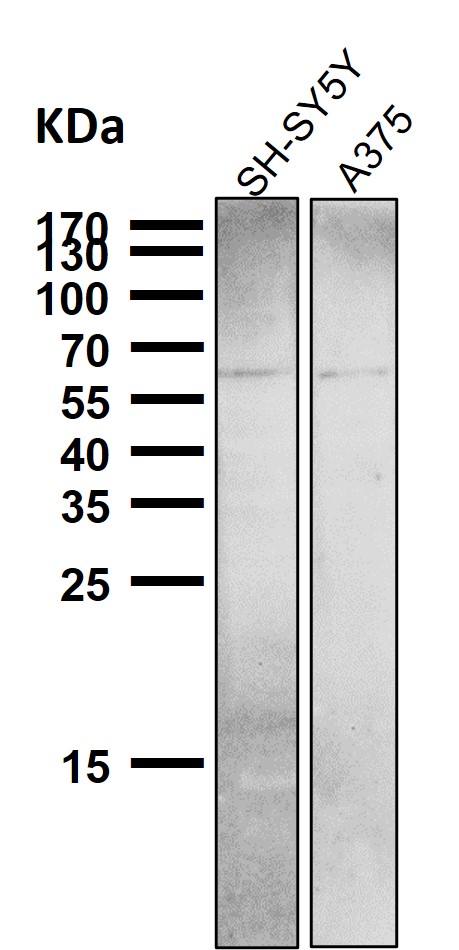 1 - Anti-NUR77 NR4A1 Rabbit Monoclonal Antibody ABO13802