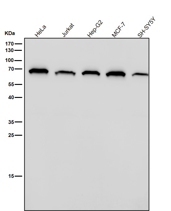 1 - Anti-NR5A2/Lrh 1 Rabbit Monoclonal Antibody ABO13804