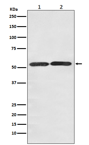 1 - Anti-GLUT3 SLC2A3 Rabbit Monoclonal Antibody ABO13806