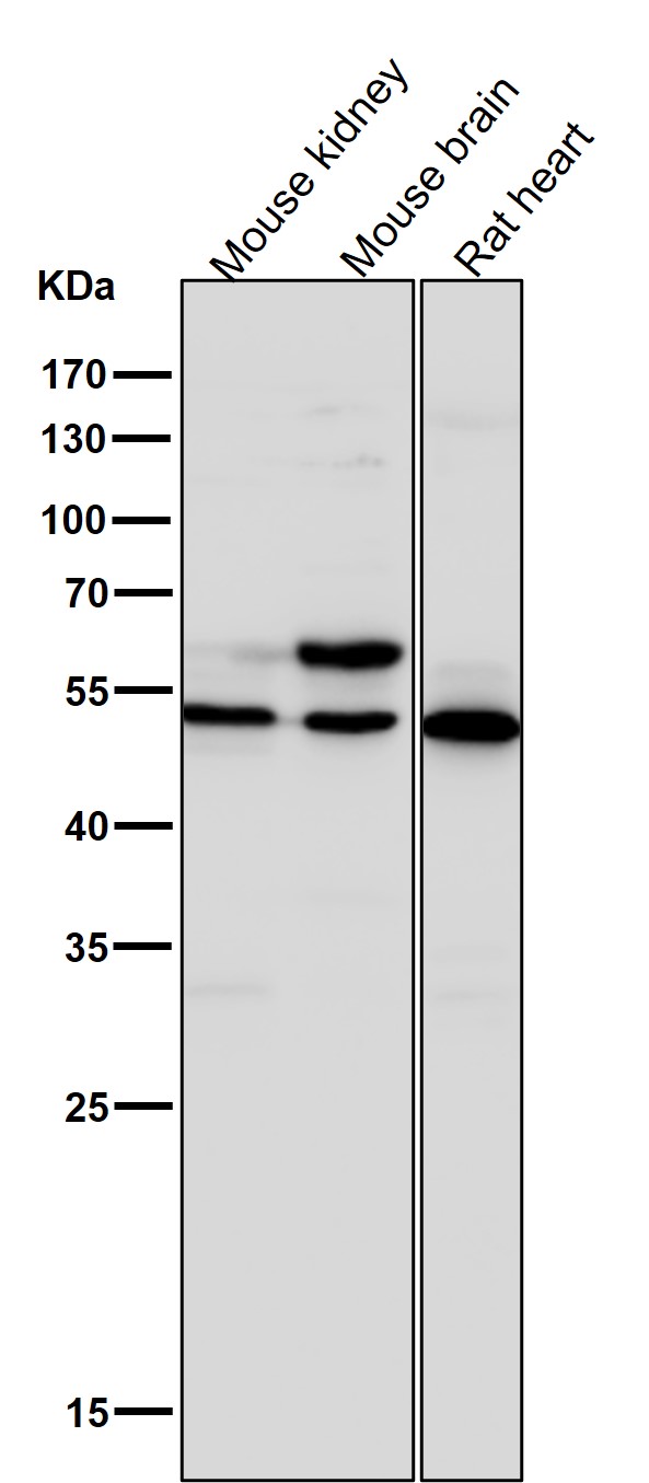 1 - Anti-GLUT3 SLC2A3 Rabbit Monoclonal Antibody ABO13806