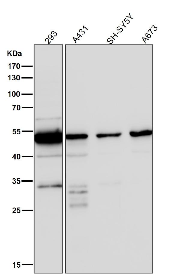 1 - Anti-GLUT3 SLC2A3 Rabbit Monoclonal Antibody ABO13806