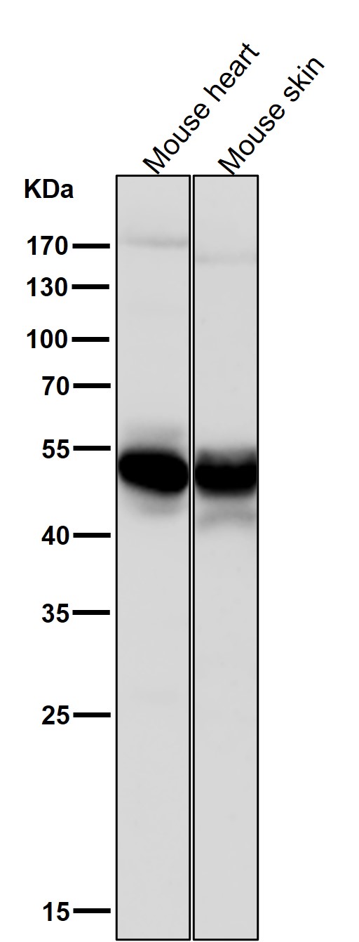 1 - Anti-GLUT3 SLC2A3 Rabbit Monoclonal Antibody ABO13806