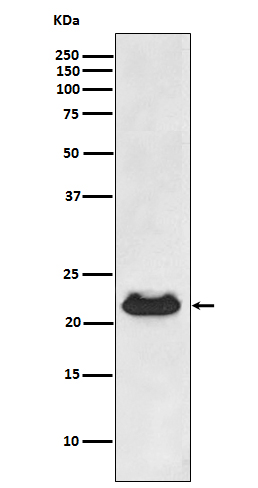 1 - Anti-CRYAB/Alpha B Crystallin Rabbit Monoclonal Antibody ABO13807