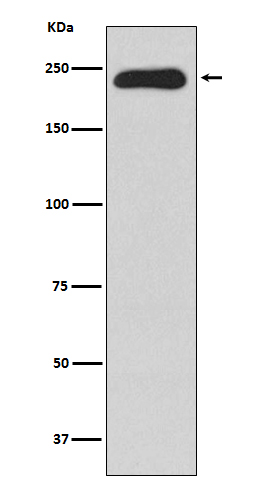 1 - Anti-MYH11 Rabbit Monoclonal Antibody ABO13808