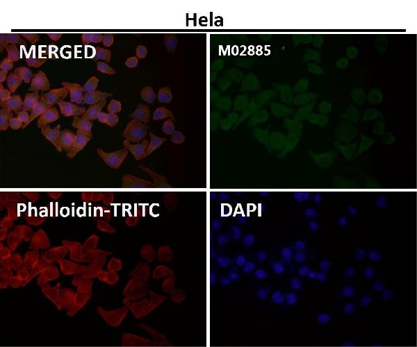 1 - Anti-Atg4B Rabbit Monoclonal Antibody ABO13810