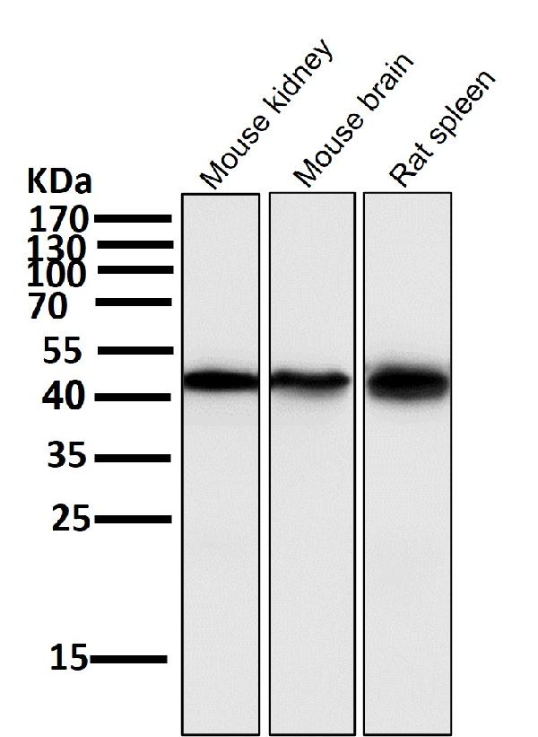1 - Anti-Atg4B Rabbit Monoclonal Antibody ABO13810