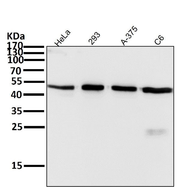 1 - Anti-Atg4B Rabbit Monoclonal Antibody ABO13810