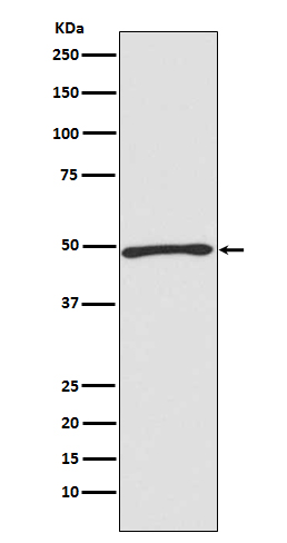 1 - Anti-Atg4C Rabbit Monoclonal Antibody ABO13811