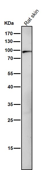 1 - Anti-Dnmt3b Rabbit Monoclonal Antibody Rabbit Monoclonal Antibody ABO13814