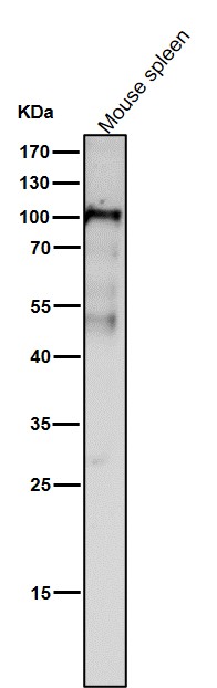 1 - Anti-Dnmt3b Rabbit Monoclonal Antibody Rabbit Monoclonal Antibody ABO13814
