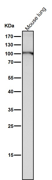 1 - Anti-Dnmt3b Rabbit Monoclonal Antibody Rabbit Monoclonal Antibody ABO13814