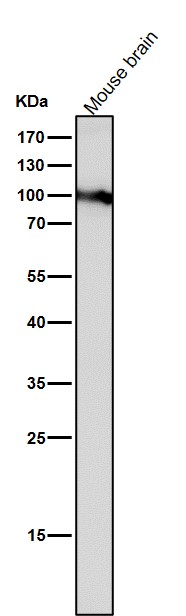 1 - Anti-Dnmt3b Rabbit Monoclonal Antibody Rabbit Monoclonal Antibody ABO13814