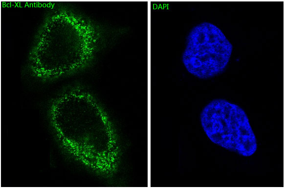 3 - Anti-Bcl-XL BCL2L1 Rabbit Monoclonal Antibody ABO13816