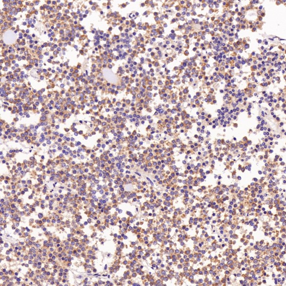 2 - Anti-Bcl-XL BCL2L1 Rabbit Monoclonal Antibody ABO13816
