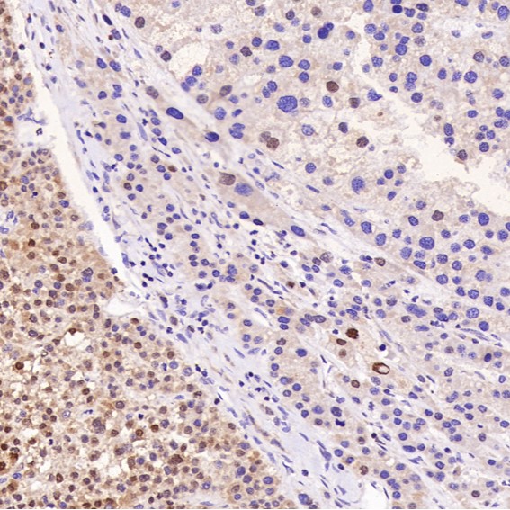 2 - Anti-Bcl-XL BCL2L1 Rabbit Monoclonal Antibody ABO13816