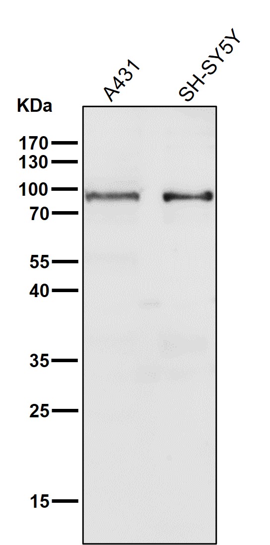 1 - Anti-STAT5a Rabbit Monoclonal Antibody ABO13817