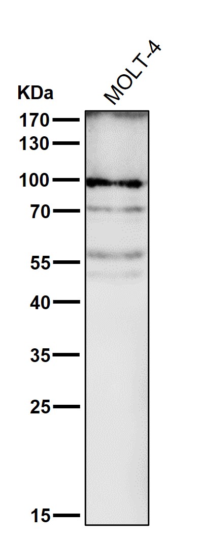 1 - Anti-STAT5a Rabbit Monoclonal Antibody ABO13817